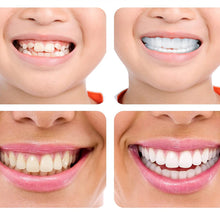 Ladda upp bild till gallerivisning, Magic Smile TandstÀllning