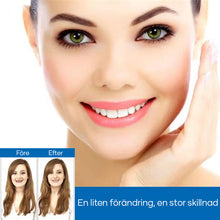 Ladda upp bild till gallerivisning, Magic Smile TandstÀllning