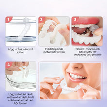 Ladda upp bild till gallerivisning, Magic Smile TandstÀllning