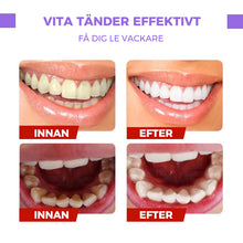 Ladda upp bild till gallerivisning, Serum för tandfärgskorrigering