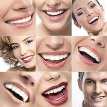 Ladda upp bild till gallerivisning, Magic Smile TandstÀllning