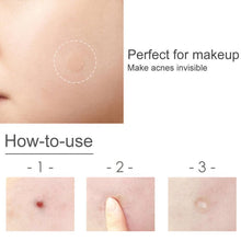 Ladda upp bild till gallerivisning, Acne Hudvård Vårdande & Absorberande omslag, 30 stycken
